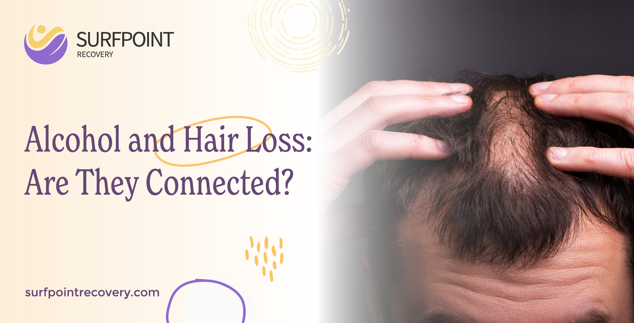 Alcohol and Hair Loss: Are They Connected?